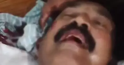 పొన్నూరు: మన్నవ గ్రామ సర్పంచ్, వైసీపీ నేత నాగమల్లేశ్వరరావుపై గుర్తు తెలియని వ్యక్తుల దాడి