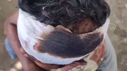 देेेवरिया: सवरेजी मणि गांव में ₹1400 के लिए दबंगों ने की पिटाई, घायल युवक का मेडिकल कॉलेज में हुआ इलाज