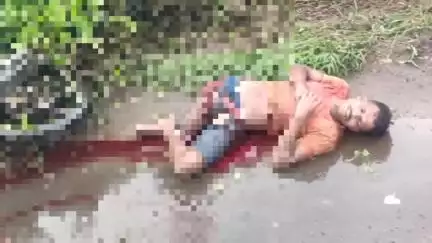 আউশগ্রাম ১: গোন্না সেতুর কাছে ভয়াবহ সড়ক দুর্ঘটনায় দ্বিখণ্ডিত হয়ে গেল বাইক আরোহী যুবকের পা, গুরুতর জখম অপর বাইক আরোহীও