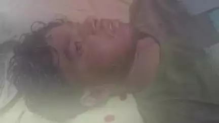গাজোল: ১৭ বছরের ১ মোটর বাইক আরোহী নিয়ন্ত্রণ হারিয়ে সড়কের উপর পড়ে গিয়ে জখম হয়