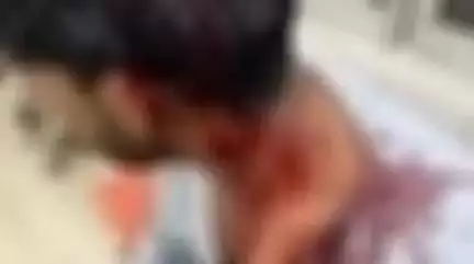 बिजनौर: नगीना रोड पर आईटीआई कॉलेज के पास आधा दर्जन युवकों ने एक युवक पर किया जानलेवा हमला