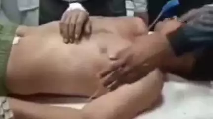 हाथरस: गांव अलीपुर मोहरिया में शराब के नशे में कुएं में गिरे युवक को सांप ने काटा, हालत बिगड़ने पर परिजन अस्पताल आए, अलीगढ़ रेफर