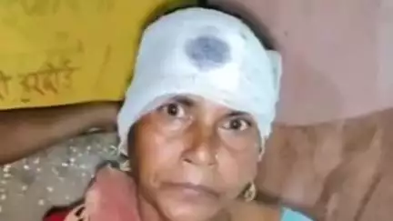 बिलग्राम: नाऊपुरवा गांव में नाले का पानी घर में जाने पर हुआ हिंसक विवाद, लाठी-डंडे चले, गुड्डी देवी व कोमल हुईं घायल