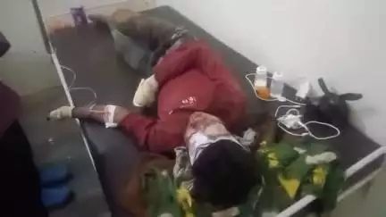 गोपद बनास: सीधी जिले के बरदैला घाटी में तेज रफ्तार बाइक दुर्घटनाग्रस्त, चालक गंभीर रूप से घायल