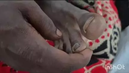 कोंडागांव: बोरगांव में 17 वर्षीय नाबालिक सर्प दंश का शिकार, उपचार हेतु फरसगांव अस्पताल में भर्ती किया गया
