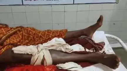 शहपुरा: बांसा गांव में बैल ने महिला पर किया हमला, महिला गंभीर रूप से घायल, शहपुरा अस्पताल से जबलपुर रेफर