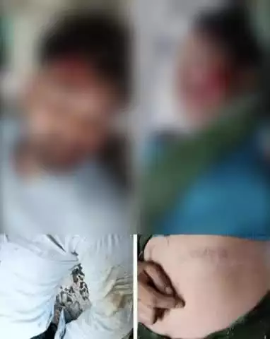 कालपी: जोल्हुपुर रेलवे फ्लाईओवर ओवरब्रिज से नीचे गिरे बाइक सवार मां-बेटे, मां की हुई मौत और बेटा रेफर