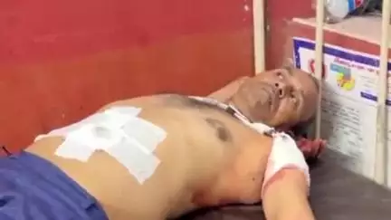 गोला: बड़हलगंज के लालगंज कसाब टोले के निवासी दर्जी पर नशेड़ी ने कांगोंघाट के पास चाकू से किया हमला