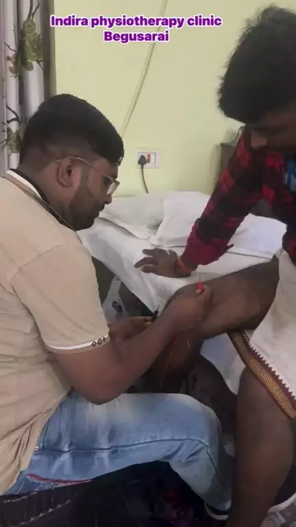 Treating with dry needling #physiotherapy #begusarai