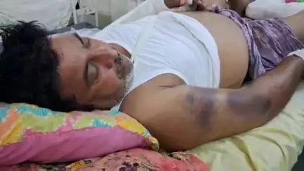 चूरू: चैनपुरा छोटा टोल नाका पर लूट के इरादे से एक युवक के साथ की गई मारपीट, जिला अस्पताल में इलाज जारी