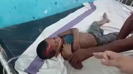 छपरा: छपिया बिन टोली गांव में एसएच-73 पर कार की टक्कर से 5 वर्षीय लड़का घायल
