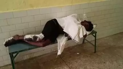 दुधि: बीडर गांव में तेज रफ्तार बाइक अनियंत्रित होकर गिरी, बाइक सवार 3 लोग गंभीर रूप से हुए घायल
