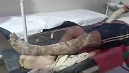 महाराजगंज: दूलमपुर में मधुमक्खी के हमले से दो मजदूर गंभीर रूप से घायल, नाले में कूदकर बचाई जान