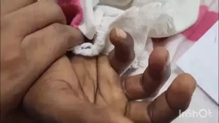 जहानाबाद: अकबरपुर निवासी युवक को बिच्छू ने काटा, हालत बिगड़ने पर सदर अस्पताल में भर्ती