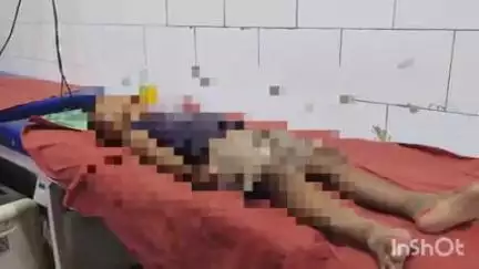 खलीलाबाद: नगवा गांव की 5 वर्षीय बच्ची छत से गिरी, गंभीर चोट के कारण मेडिकल कॉलेज के डॉक्टर ने किया रेफर