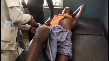अतर्रा: ओरन में घर से बाहर जाते समय सर्प ने एक व्यक्ति को काटा, हालत गंभीर, सीएचसी में कराया भर्ती