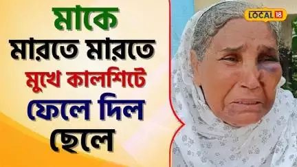 Bangla News  ছিঃ ছিঃ! সামান্য খেতে চাওয়ার অপরাধে মাকে মেরে মুখে কালশিটে ফেল দিল ছেলে #Local18