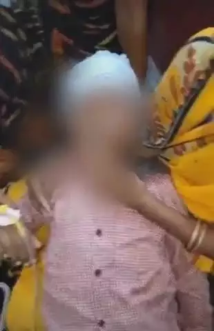 फतेेहपुर: सड़क पार करते समय हादसा, लालपुर निवासी 9 साल का मासूम गंभीर रूप से घायल