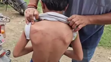 जमुनहा: जमुनहा क्षेत्र के निजी विद्यालय की शिक्षिका ने कक्षा 1 के छात्र को पीटा, शिक्षिका बर्खास्त, प्रबंधक और प्रधानाचार्य को नोटिस