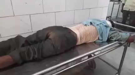 औरंगाबाद: मुफस्सिल थाना क्षेत्र के खैराबिंद गांव के स्कूल के समीप बाइक सवार ने युवक को मारी टक्कर, घायल अवस्था में किया गया रेफर