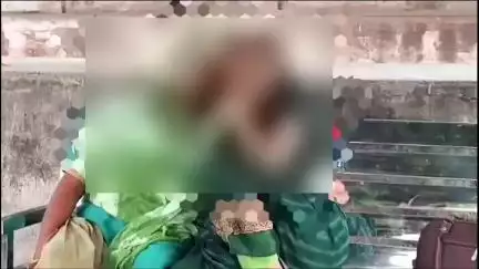 इटावा: सहसो इलाके में छेड़खानी से तंग आकर खुद को आग लगाने वाली नाबालिग किशोरी की सैफई पीजीआई में इलाज के दौरान हुई मौत