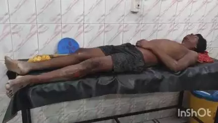 मधेपुरा: बेलो गांव में सड़क दुर्घटना, बाइक सवार संजीव कुमार बुरी तरह जख्मी, अस्पताल में भर्ती