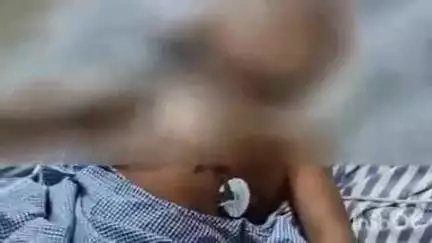 बंजरिया: चिचोरहिया में शनिवार रात बाइक की ठोकर से 6 वर्षीय बच्चा गंभीर रूप से घायल, निजी हॉस्पिटल में हुआ ऑपरेशन