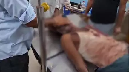 दमोह: पटी कला में बाघ ने हमला कर एक व्यक्ति को किया घायल, गंभीर हालत में ज़िला अस्पताल में कराया गया भर्ती