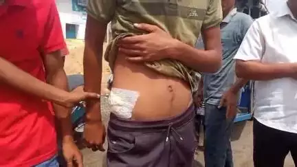নাকাশিপাড়া: বেথুয়াডহরিতে  দুই দলের বচসার জেরে যুবকের পেটে ধারাল অস্ত্রের কোপ মারার অভিযোগ, গ্রেপ্তার 1