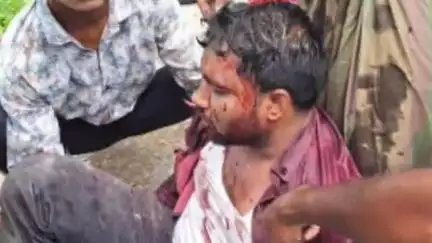 হাসনাবাদ: হাবাসপুরে বাইক দুর্ঘটনায় এক ব্যক্তিকে গুরুতর অবস্থায় ভর্তি টাকী গ্রামীণ হাসপাতালে