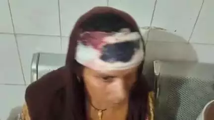 खागा: हाकिमपुर खंतवा में दरवाजे के पास बकरी जाने पर दबंग पड़ोसी ने की मारपीट, महिला सहित 5 घायल, खखरेडू का मामला
