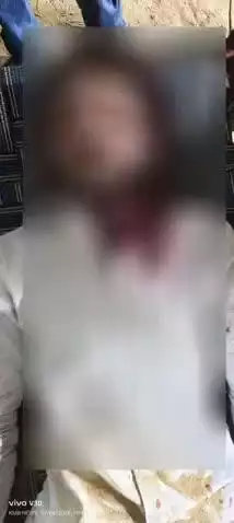 लंभुआ: बीती रात मेले से लौटे युवकों पर हमला, गोली मारने का आरोप, घायलों को मेडिकल कॉलेज में कराया गया भर्ती