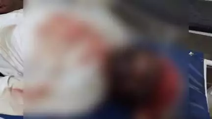 बिलारी: मुरादाबाद रोड स्थित मुखिया ढाबे के पास अज्ञात वाहन की टक्कर से बाइक पर सवार एक की मौत, दूसरा गंभीर रूप से घायल