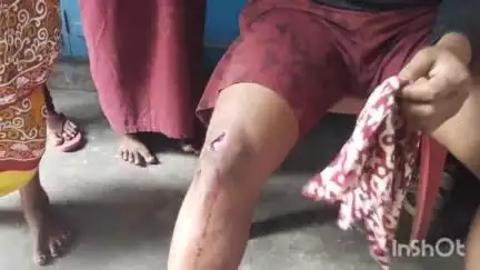 গঙ্গারামপুর: গঙ্গারামপুর নিউমার্কেট এলাকায় দুই পক্ষের সংঘর্ষে রণক্ষেত্র,সংঘর্ষে আহত ২