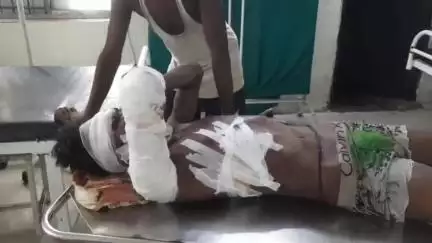 भिंड नगर: बीरेंद्र बाटिका के पास दीवार गिरने से मलबे में दबकर दो मजदूर घायल