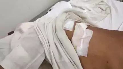 निचलौल: ग्राम सभा मुड़ेरी में नशे में धुत युवक ने पिता और भतीजे पर चाकू से किया हमला, दोनों गंभीर घायल