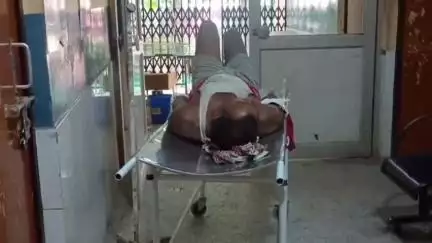 निचलौल: ग्राम सभा बलहीखोर में करंट की चपेट में आने से युवक की हालत गंभीर