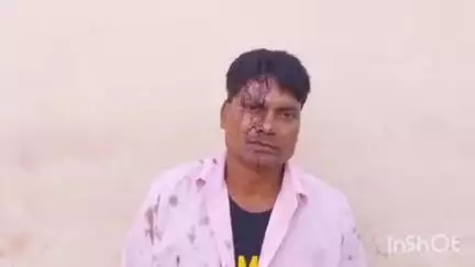 इगलास: इगलास कोतवाली क्षेत्र के ग्राम व्योंही में रिश्तेदार दो पक्षों के बीच जमकर चले लाठी-डंडे, बीच-बचाव में एक युवक हुआ घायल