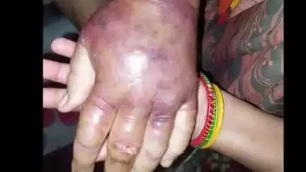 कोल: गांव नेहरा में वृद्ध व्यक्ति अनजान कीड़े का शिकार हुआ, निजी अस्पताल में उपचार के दौरान हुई मौत