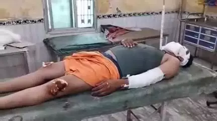 गोपालगंज: मध्ववा लाल के पास अज्ञात वाहन की टक्कर से बाइक सवार युवक जख्मी, सदर अस्पताल में भर्ती