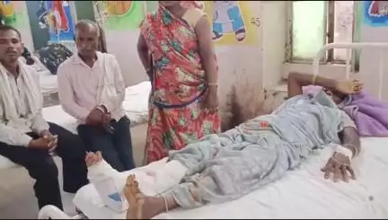 बांसवाड़ा: डाबड़ी गांव में ऑटो से उतर रही महिला को कार ने मारी टक्कर, पैर पर लगी चोट