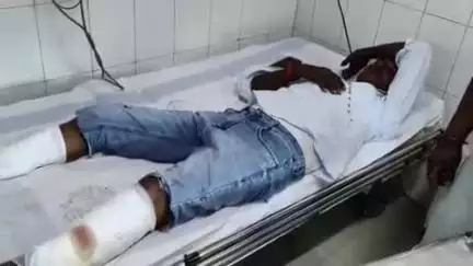 मोहनिया: रामगढ़ के पब्लिक एप के पूर्व पत्रकार रतवार नदी के पास सड़क दुर्घटना के शिकार, अस्पताल से उपचार के बाद हुए रेफर