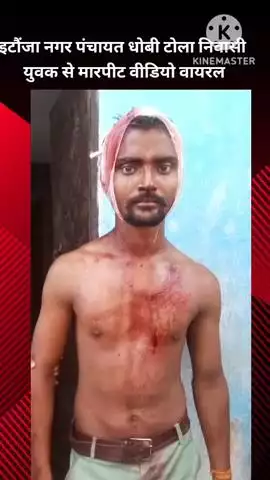 बख्शी का तालाब: इटौंजा नगर पंचायत के धोबी टोला मोहल्ला निवासी युवक के साथ की गई मारपीट, वीडियो हुआ वायरल