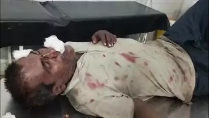 जमुआ: रेलवे स्टेशन रोड, अल्टा बंगला के पास अज्ञात व्यक्ति घायल मिला, राहगीरों ने सदर अस्पताल पहुंचाया