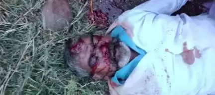 ఉరవకొండ: గోపులాపురం వద్ద రోడ్డు ప్రమాదంలో తీవ్రంగా గాయపడిన వ్యక్తి చికిత్స పొందుతూ మృతి