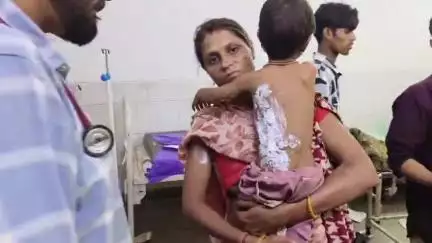 डूंगरपुर: गर्म चाय गिरने से 2 वर्ष की शिशु झुलसी