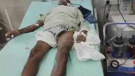 फिरोज़ाबाद: बसइमोहम्मदपुर थाना क्षेत्र के रामदासपुरा में गले पर दो फुट के सांप ने डसा, बुजुर्ग ने फेंका ज़हरीला नाग, हालत नाजुक