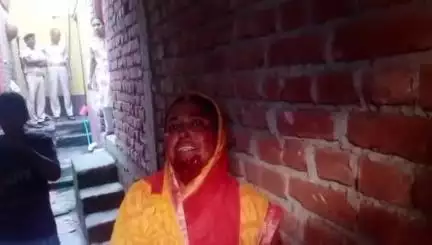 नोखा: खरवत गांव में पारिवारिक विवाद के दौरान मारपीट में एक महिला हुई घायल