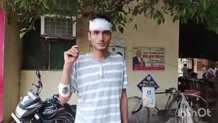 जलालाबाद: मोहल्ला नौसरा में बड़े भाइयों और भाभियों ने युवक के साथ की मारपीट, सिर फटने से हुआ घायल