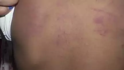 रायगढ़: आनंद मार्ग स्कूल बेलाडुला में शिक्षक ने साढ़े तीन साल के नर्सरी छात्र से की मारपीट, पिता ने सस्पेंड करने की मांग की